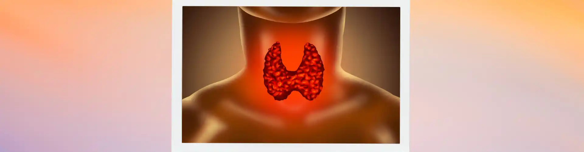 Hypothyroidism Type II - Managing how your cells use oxygen to make energy